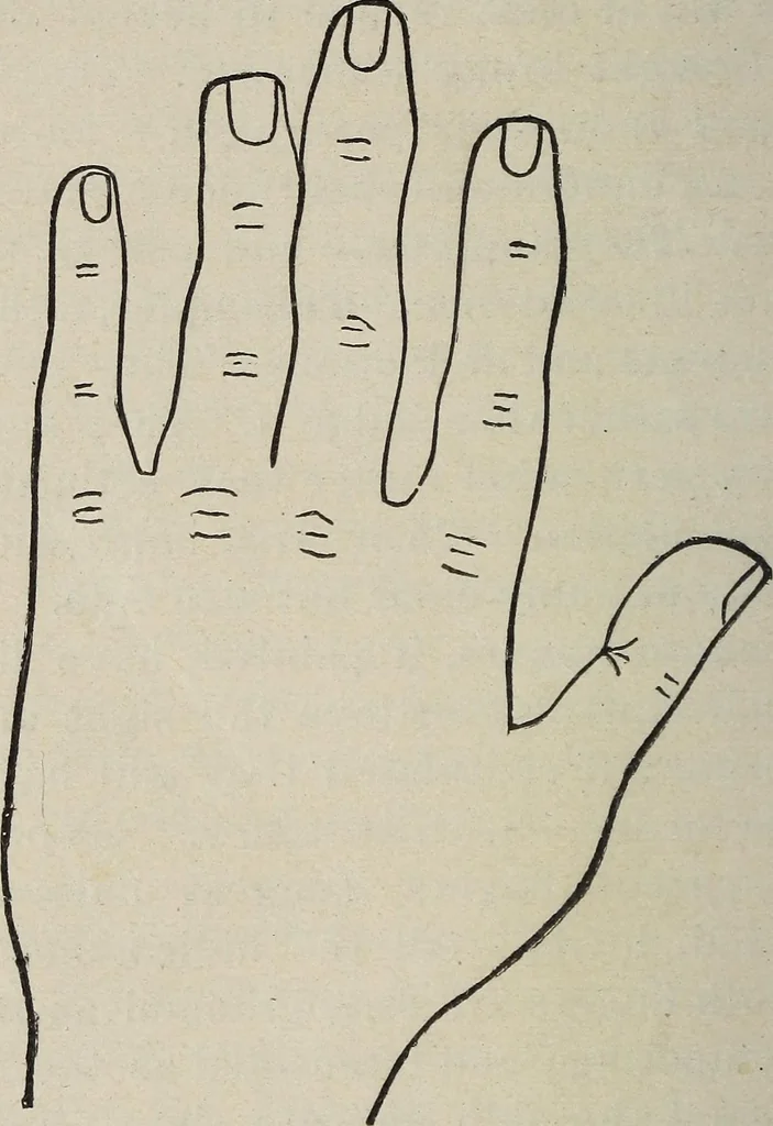An illustration from Philosophic chiromancy. Mysteries of the hand revealed and explained: the art of determining, from an inspection of the hands, the person's temperature, appetites, passions, impulses, aspirations, mental endowments, character and tendencies, 1879, leaf 77
