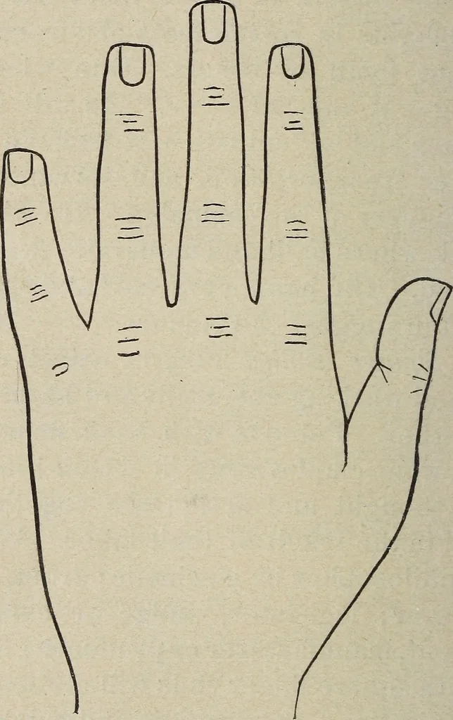 An illustration from Philosophic chiromancy. Mysteries of the hand revealed and explained: the art of determining, from an inspection of the hands, the person's temperature, appetites, passions, impulses, aspirations, mental endowments, character and tendencies, 1879, leaf 85