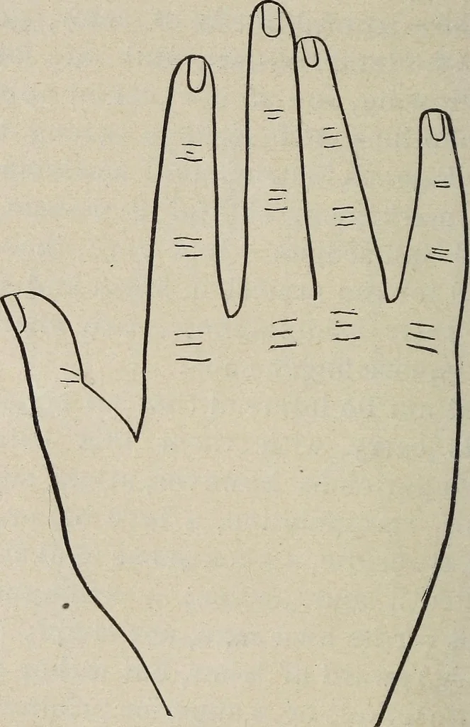 An illustration from Philosophic chiromancy. Mysteries of the hand revealed and explained: the art of determining, from an inspection of the hands, the person's temperature, appetites, passions, impulses, aspirations, mental endowments, character and tendencies, 1879, leaf 87