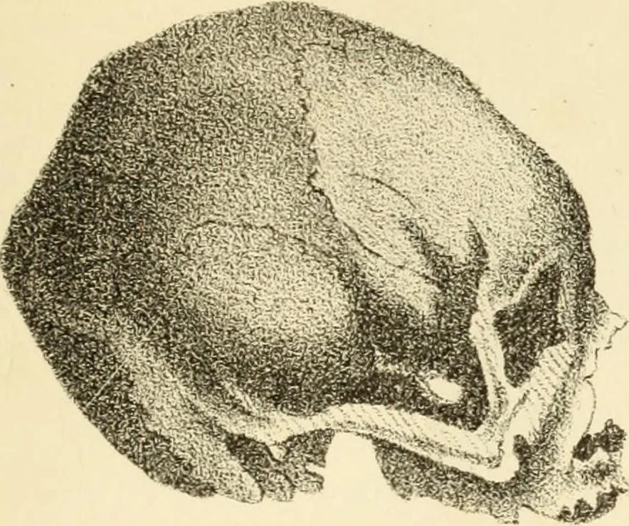 An illustration from Phrenology in connection with the study of physiognomy : to which is prefixed a biography of the author by Nahum Capen, 1836, leaf 398
