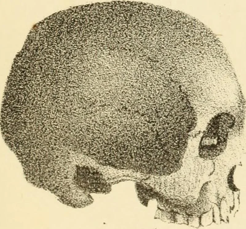 An illustration from Phrenology in connection with the study of physiognomy : to which is prefixed a biography of the author by Nahum Capen, 1836, leaf 398