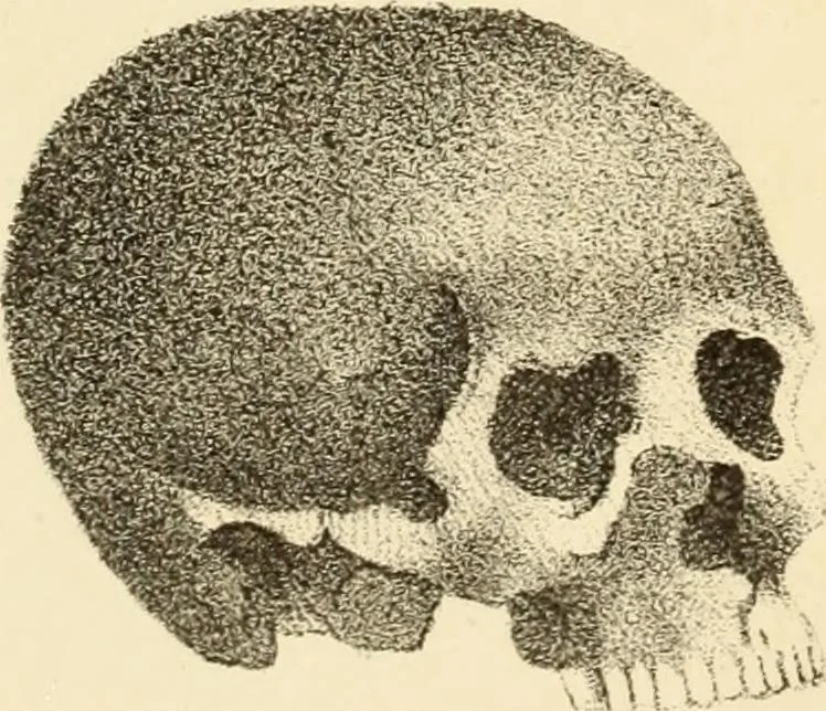An illustration from Phrenology in connection with the study of physiognomy : to which is prefixed a biography of the author by Nahum Capen, 1836, leaf 398
