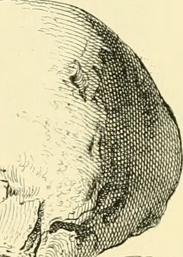 An illustration from Phrenological development of Robert Burns, from a cast of his skull moulded at Dumfries, the 31st day of March, 1834, 1859, leaf 7