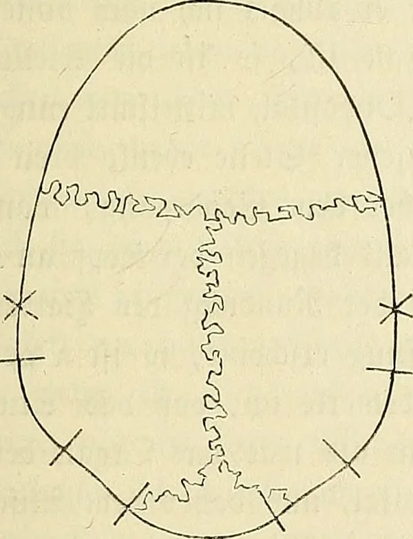 An illustration from Phrenologische Bilder : zur Naturlehre des menschlichen Geistes und deren Anwendung Wissenschaft und Leben, 1855, leaf 194