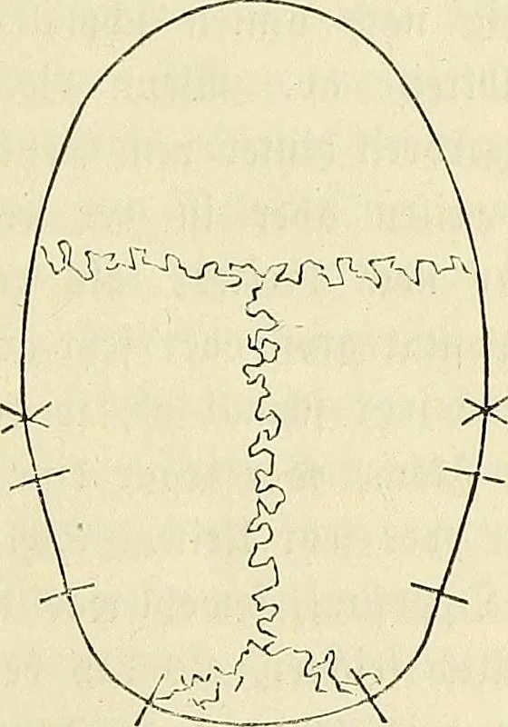 An illustration from Phrenologische Bilder : zur Naturlehre des menschlichen Geistes und deren Anwendung Wissenschaft und Leben, 1855, leaf 194