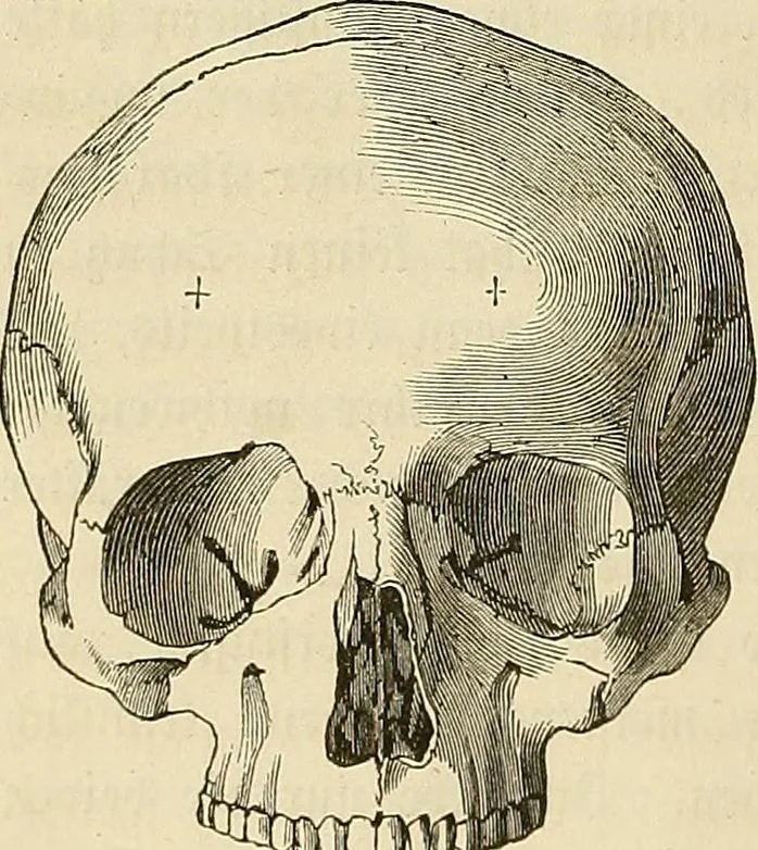 An illustration from Phrenologische Bilder : zur Naturlehre des menschlichen Geistes und deren Anwendung Wissenschaft und Leben, 1855, leaf 241