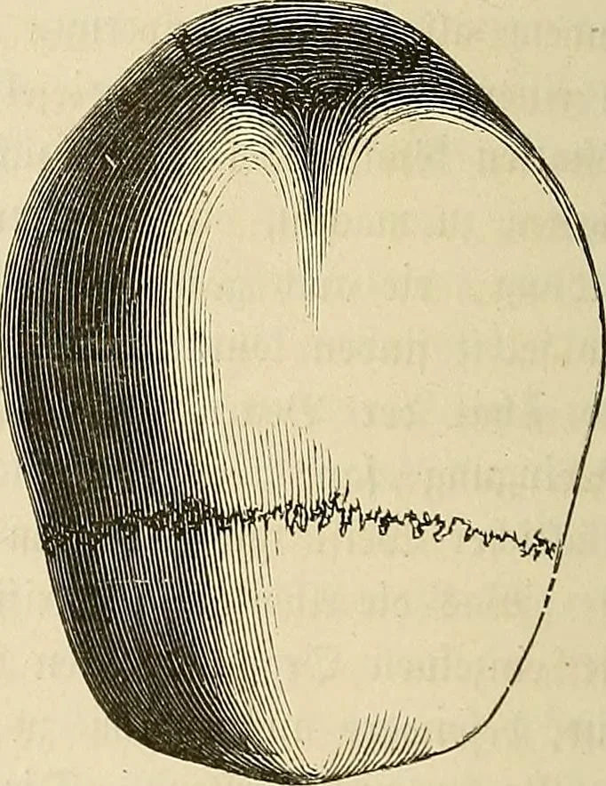 An illustration from Phrenologische Bilder : zur Naturlehre des menschlichen Geistes und deren Anwendung Wissenschaft und Leben, 1855, leaf 241