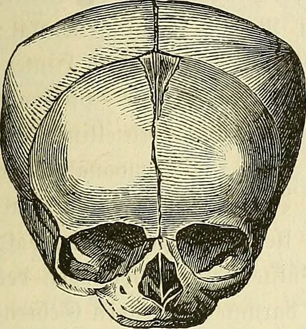 An illustration from Phrenologische Bilder : zur Naturlehre des menschlichen Geistes und deren Anwendung Wissenschaft und Leben, 1855, leaf 336