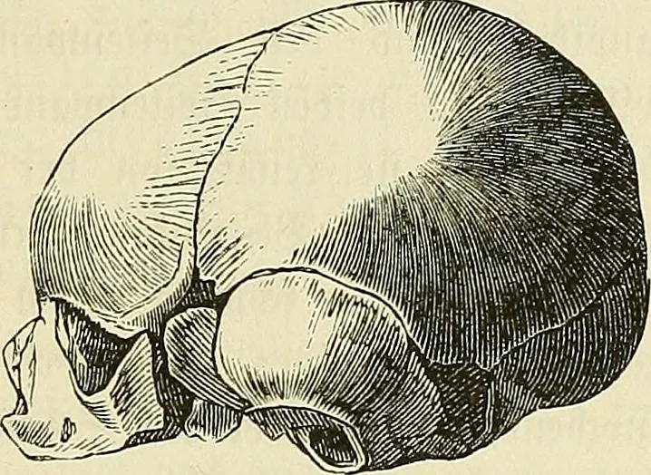 An illustration from Phrenologische Bilder : zur Naturlehre des menschlichen Geistes und deren Anwendung Wissenschaft und Leben, 1855, leaf 336
