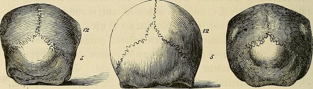 An illustration from Phrenologische Bilder : zur Naturlehre des menschlichen Geistes und deren Anwendung Wissenschaft und Leben, 1855, leaf 347