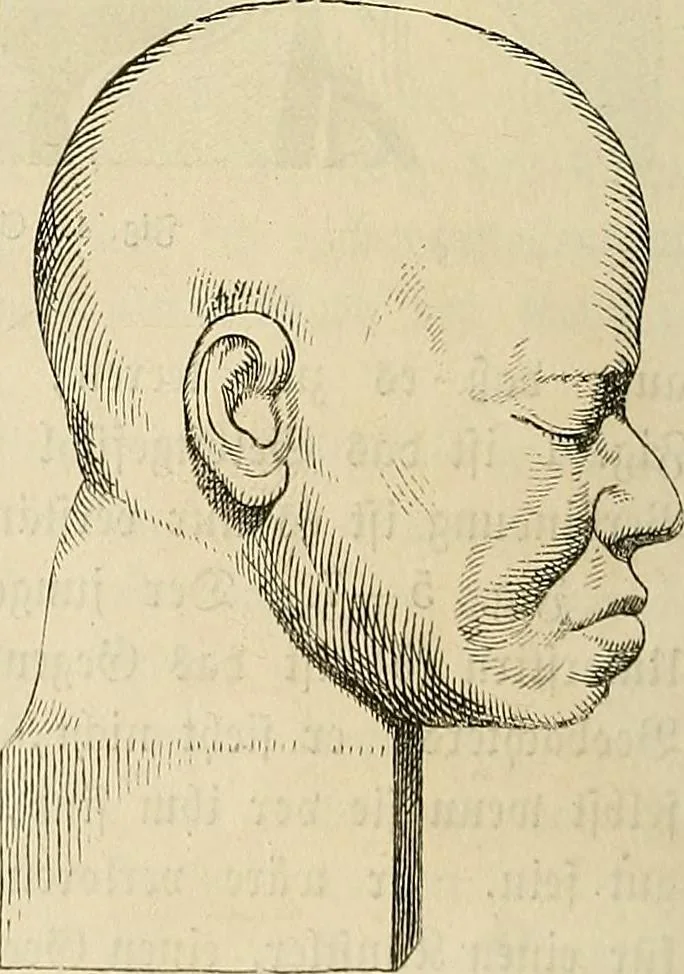 An illustration from Phrenologische Bilder : zur Naturlehre des menschlichen Geistes und deren Anwendung Wissenschaft und Leben, 1855, leaf 353