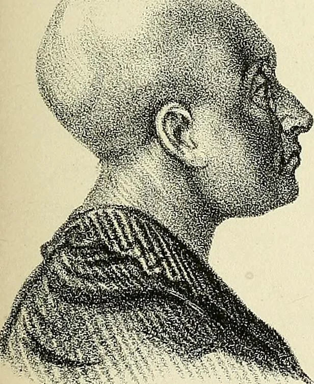 An illustration from Phrenologische Bilder : zur Naturlehre des menschlichen Geistes und deren Anwendung Wissenschaft und Leben, 1855, leaf 388