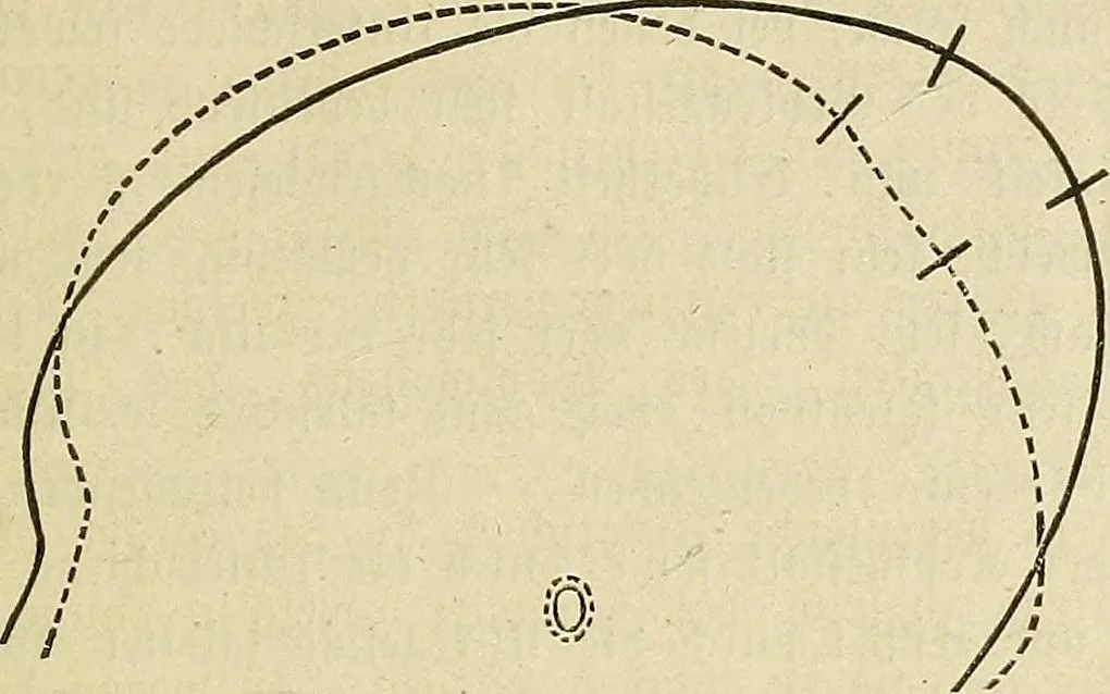 An illustration from Phrenologische Bilder : zur Naturlehre des menschlichen Geistes und deren Anwendung Wissenschaft und Leben, 1855, leaf 472