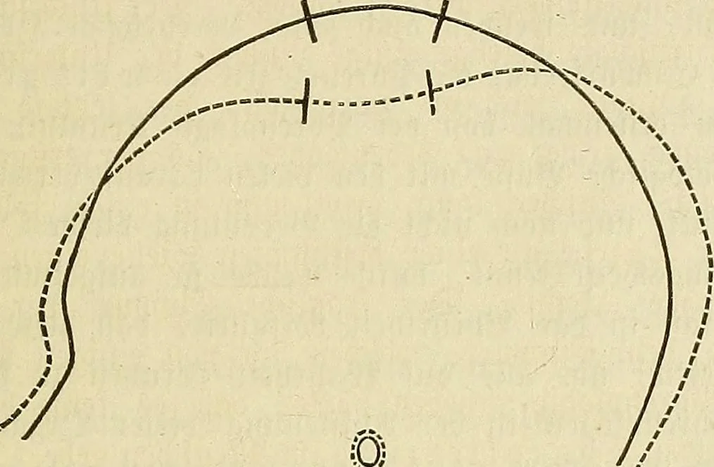 An illustration from Phrenologische Bilder : zur Naturlehre des menschlichen Geistes und deren Anwendung Wissenschaft und Leben, 1855, leaf 472