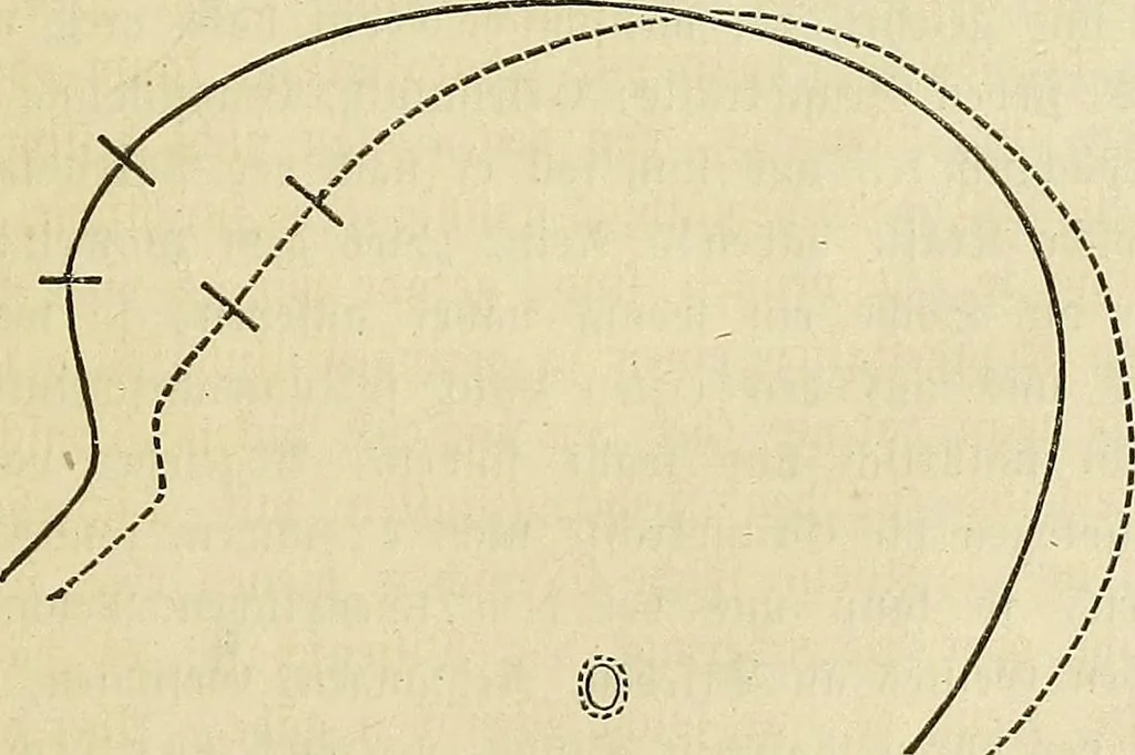 An illustration from Phrenologische Bilder : zur Naturlehre des menschlichen Geistes und deren Anwendung Wissenschaft und Leben, 1855, leaf 472