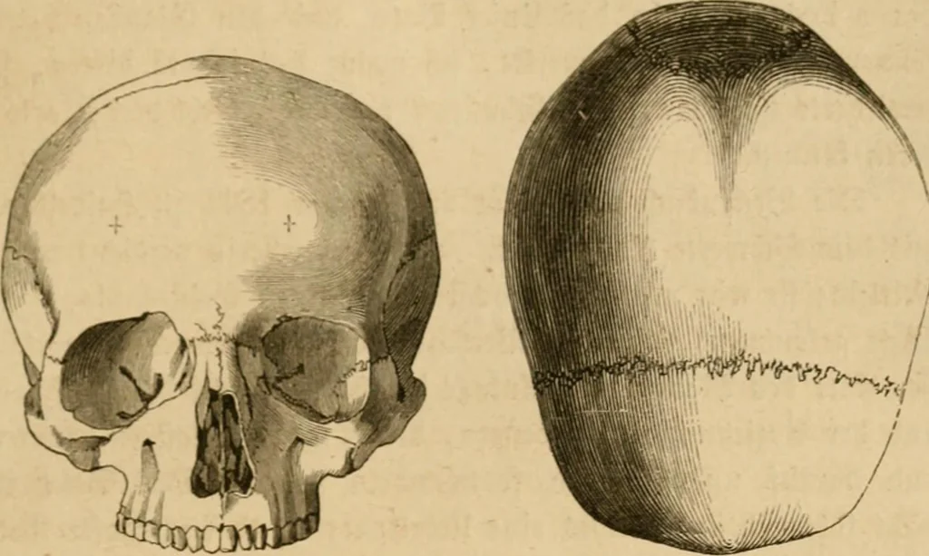 An illustration from Phrenologische Bilder : zur Naturlehre des menschlichen Geistes und deren Anwendung Wissenschaft und Leben, 1855, leaf 328