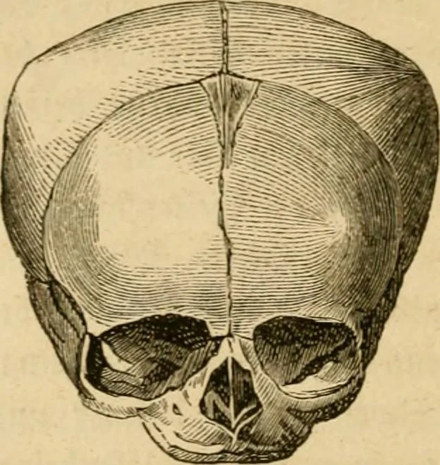 An illustration from Phrenologische Bilder : zur Naturlehre des menschlichen Geistes und deren Anwendung Wissenschaft und Leben, 1855, leaf 335