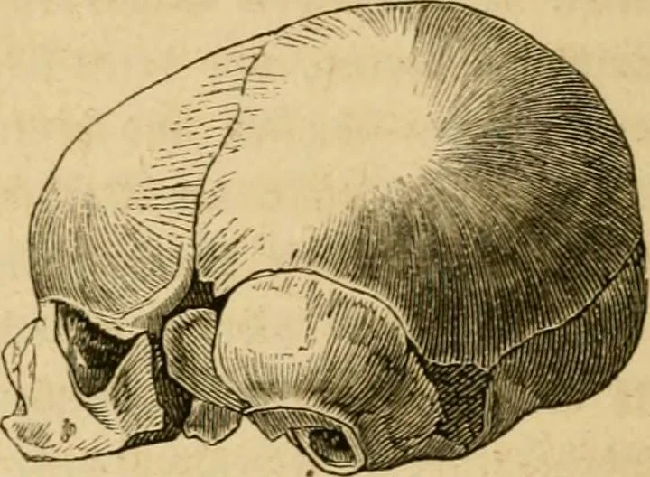 An illustration from Phrenologische Bilder : zur Naturlehre des menschlichen Geistes und deren Anwendung Wissenschaft und Leben, 1855, leaf 335