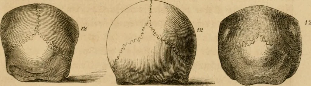 An illustration from Phrenologische Bilder : zur Naturlehre des menschlichen Geistes und deren Anwendung Wissenschaft und Leben, 1855, leaf 348