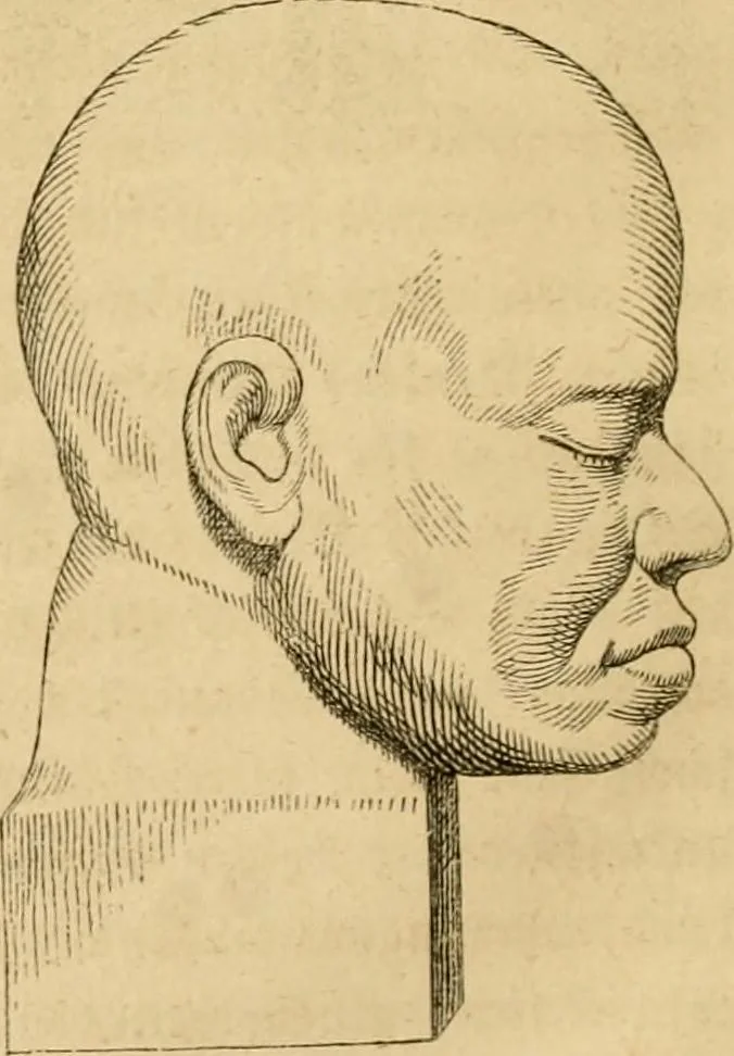 An illustration from Phrenologische Bilder : zur Naturlehre des menschlichen Geistes und deren Anwendung Wissenschaft und Leben, 1855, leaf 359