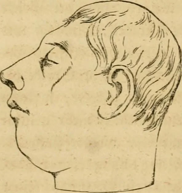 An illustration from Phrenologische Bilder : zur Naturlehre des menschlichen Geistes und deren Anwendung Wissenschaft und Leben, 1855, leaf 63