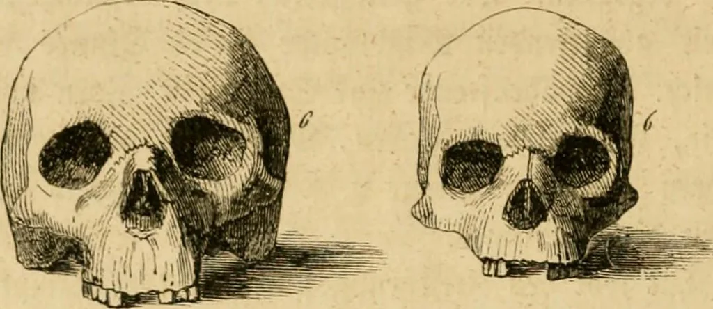 An illustration from Phrenologische Bilder : zur Naturlehre des menschlichen Geistes und deren Anwendung Wissenschaft und Leben, 1855, leaf 79