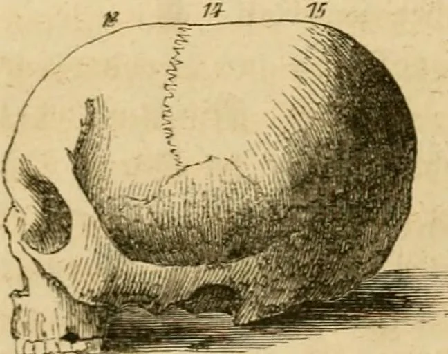 An illustration from Phrenologische Bilder : zur Naturlehre des menschlichen Geistes und deren Anwendung Wissenschaft und Leben, 1855, leaf 87