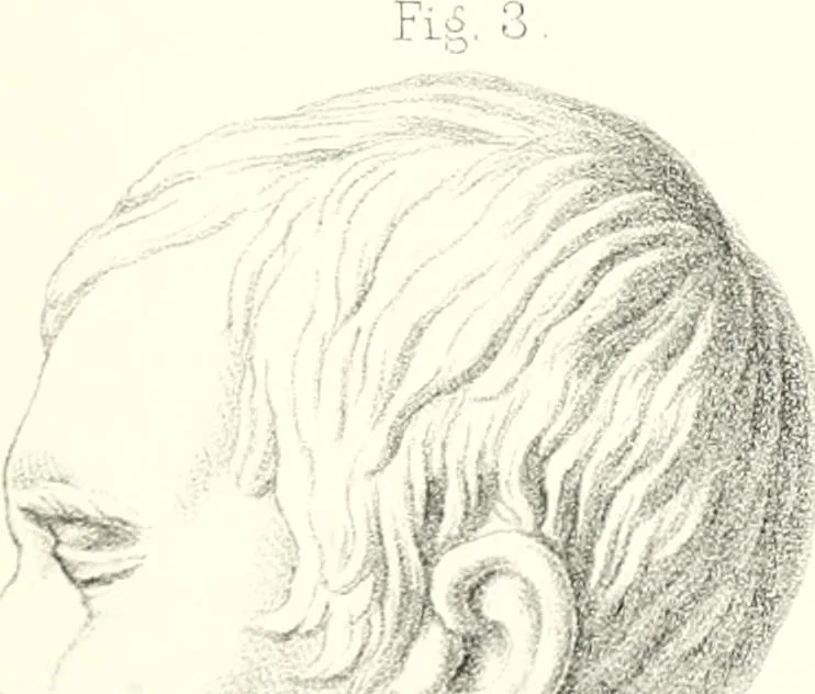 An illustration from The physical basis of mental life. A popular essay, 1873, leaf 18