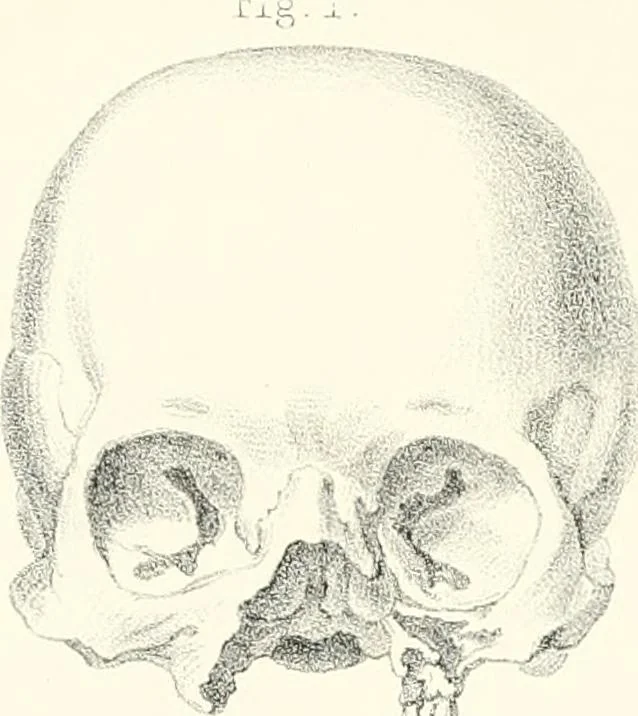 An illustration from The physical basis of mental life. A popular essay, 1873, leaf 21