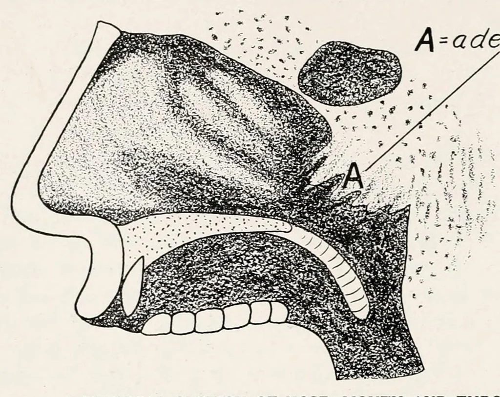An illustration from Physical education complete for schools and playgrounds, 1915, leaf 258