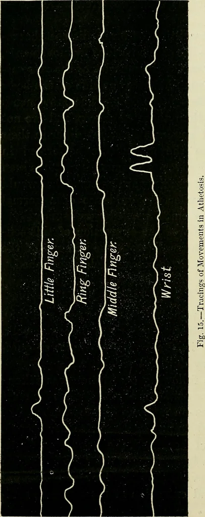 An illustration from Physical expression : its modes and principles, 1885, leaf 155