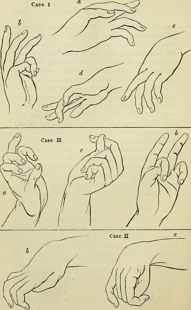 An illustration from Physical expression : its modes and principles, 1885, leaf 157