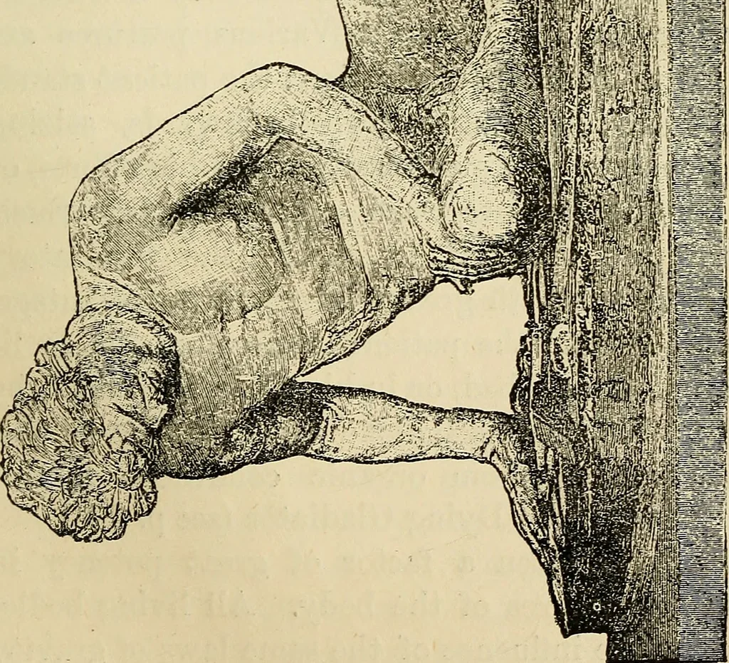 An illustration from Physical expression : its modes and principles, 1885, leaf 172