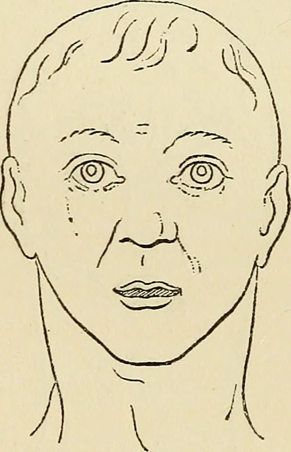 An illustration from Physical expression : its modes and principles, 1885, leaf 334