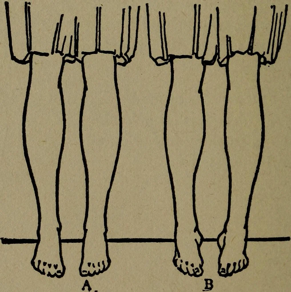 An illustration from Physical health and recreation for girls; a handbook for girls and volunteer leaders, 1920, leaf 25