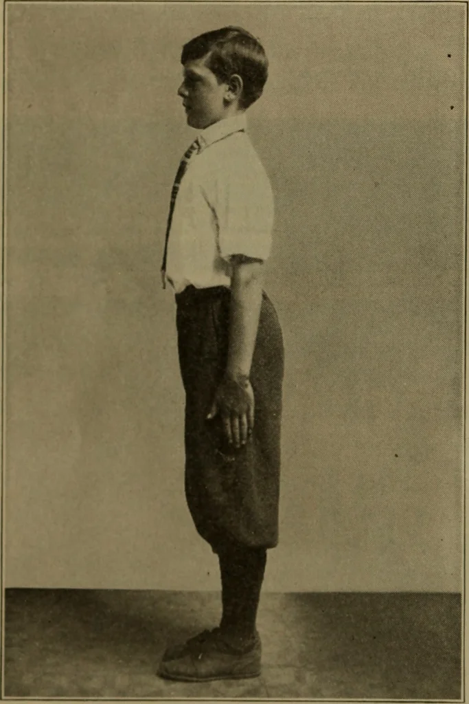 An illustration from Physical training for the elementary schools, gymnastics, games, and rhythmic plays, 1917, leaf 21
