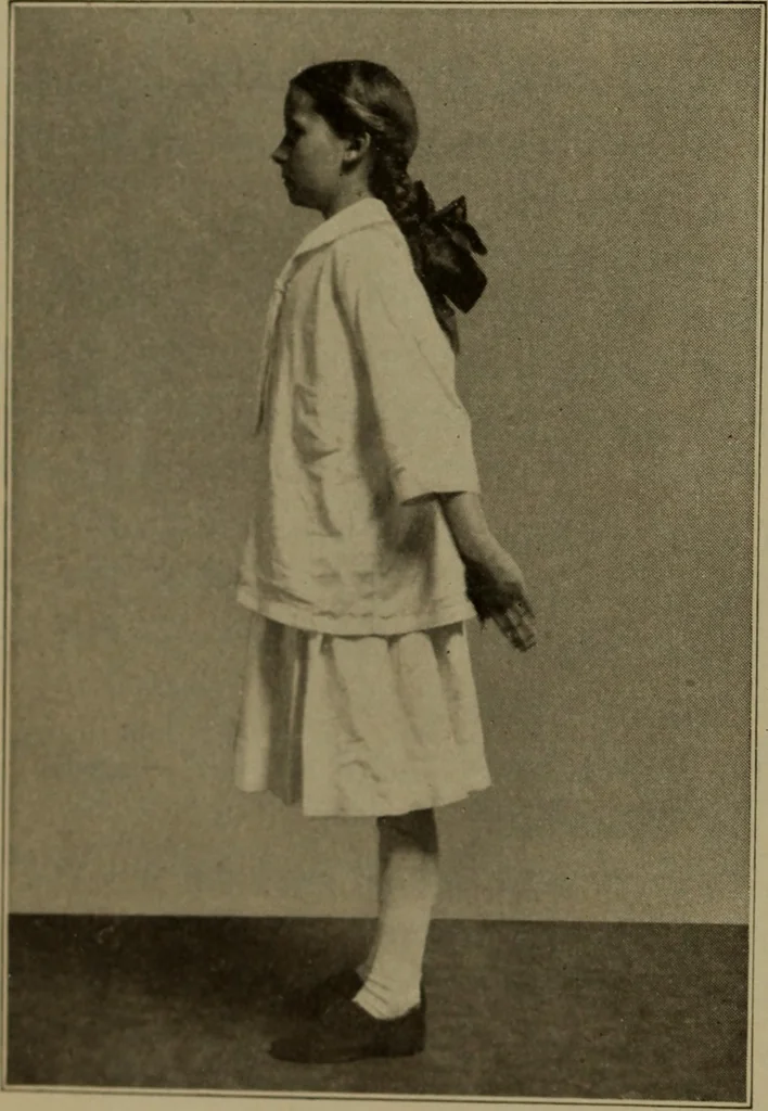 An illustration from Physical training for the elementary schools, gymnastics, games, and rhythmic plays, 1917, leaf 237