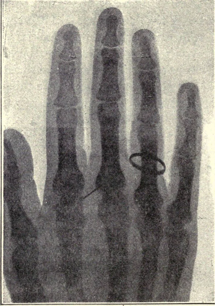 An illustration from Physics of the household, 1914, leaf 257