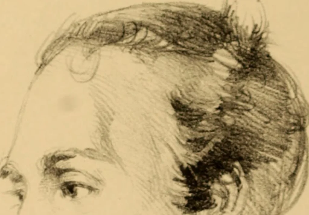 An illustration from The physiognomy of mental diseases, 1838, leaf 315