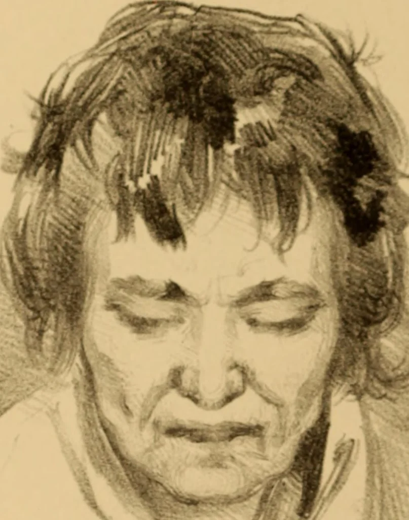 An illustration from The physiognomy of mental diseases, 1838, leaf 355