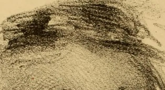 An illustration from The physiognomy of mental diseases, 1838, leaf 461