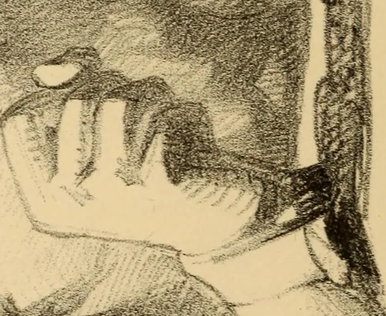 An illustration from The physiognomy of mental diseases, 1838, leaf 467