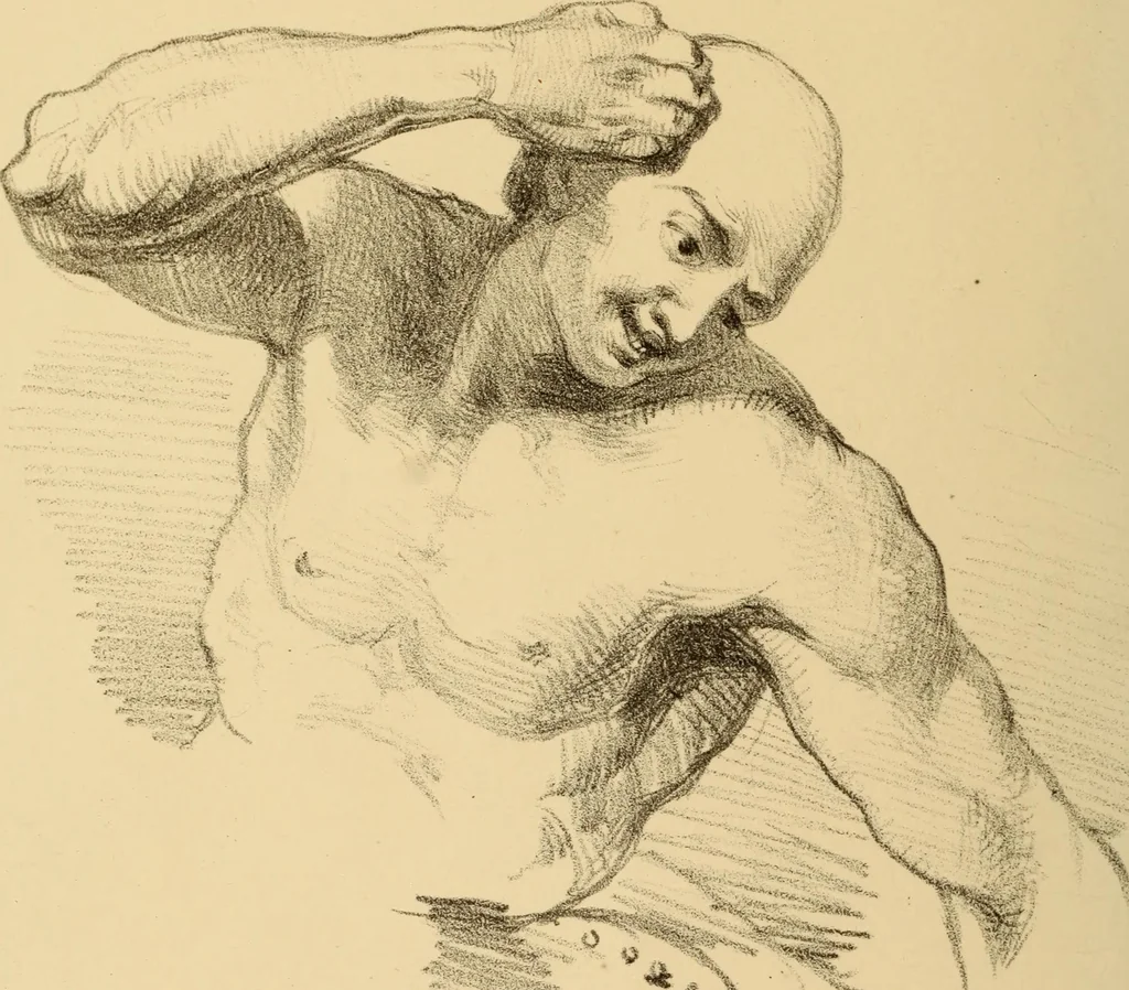An illustration from The physiognomy of mental diseases, 1838, leaf 475