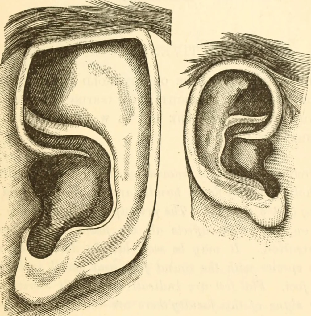 An illustration from Physiognomy illustrated ; or, Nature's revelations of character : a description of the mental, moral, and volitive dispositions of mankind, as manifested in the human form and countenance, 1891, leaf 180