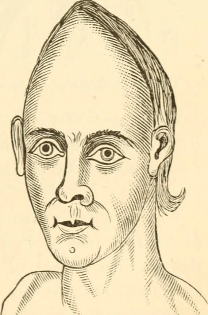 An illustration from Physiognomy illustrated ; or, Nature's revelations of character : a description of the mental, moral, and volitive dispositions of mankind, as manifested in the human form and countenance, 1891, leaf 534