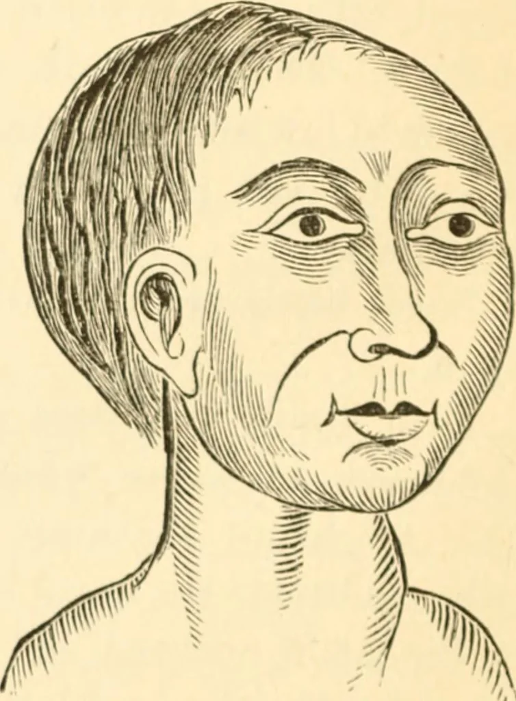 An illustration from Physiognomy illustrated ; or, Nature's revelations of character : a description of the mental, moral, and volitive dispositions of mankind, as manifested in the human form and countenance, 1891, leaf 537