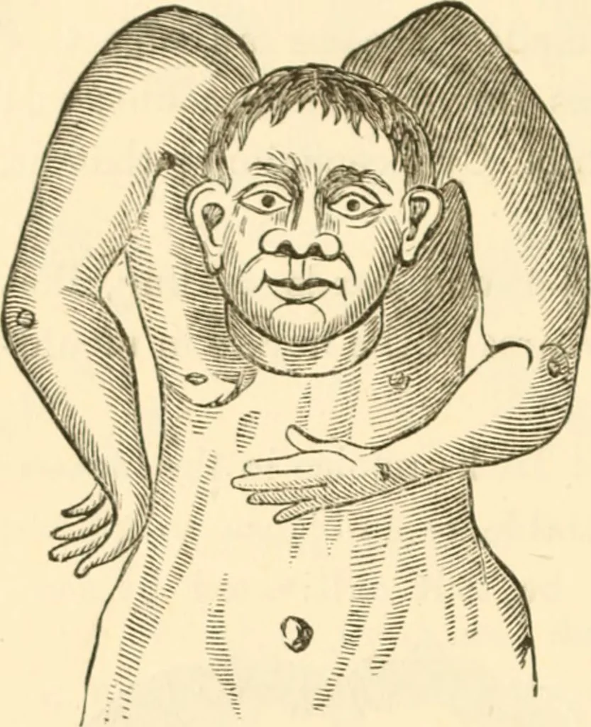An illustration from Physiognomy illustrated ; or, Nature's revelations of character : a description of the mental, moral, and volitive dispositions of mankind, as manifested in the human form and countenance, 1891, leaf 539
