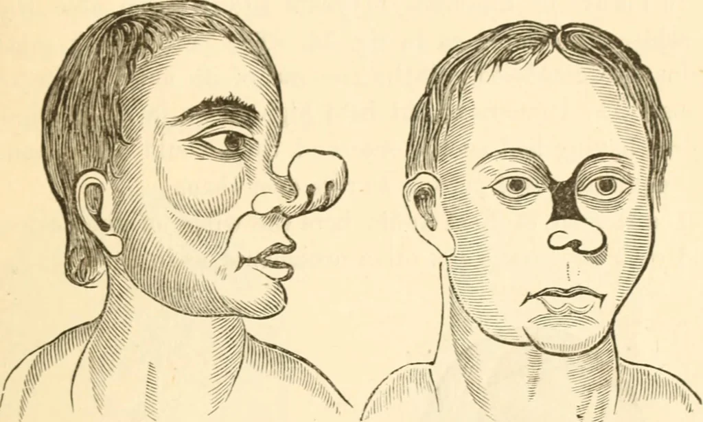 An illustration from Physiognomy illustrated ; or, Nature's revelations of character : a description of the mental, moral, and volitive dispositions of mankind, as manifested in the human form and countenance, 1891, leaf 540