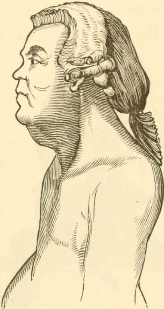 An illustration from Physiognomy illustrated ; or, Nature's revelations of character : a description of the mental, moral, and volitive dispositions of mankind, as manifested in the human form and countenance, 1891, leaf 83