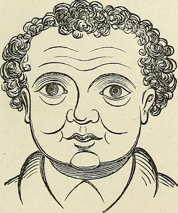 An illustration from Physiognomy illustrated; or, nature's revelations of character. A description of the mental, moral, and volitive dispositions of mankind, as manifested in the human form and countenance, 1887, leaf 388